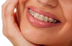Read more about the article Braces and Aligners at -30°C: A Prairie Winter Comfort Guide for Alberta and Saskatchewan Patients