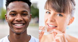 Read more about the article Braces vs. Invisalign in Camrose: Choosing the Right Treatment for Your Lifestyle
